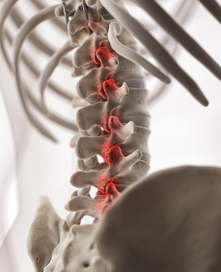 Radiofrequency Ablation Near Me in Frisco and Fort Worth TX