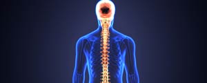 Spinal Cord Stimulator Placement Specialist Near Me in Frisco, TX and Denton, TX