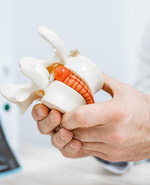 Disc Herniation Specialists Near Me in Frisco and Fort Worth TX