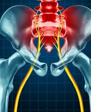 Sciatica Treatment Near Me in Frisco, TX, and Denton, TX