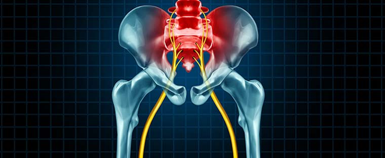 Sciatica Treatment Specialists in Schertz TX