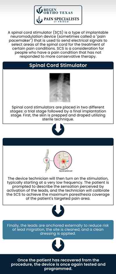 A spinal cord stimulator is a medical device that a medical professional can implant in your body to alleviate severe pain. Spinal cord stimulator implantation is typically reserved for patients who have not responded to conservative treatments. A stimulator can be implanted for a variety of reasons, but the most common one is failure with prior back surgery. The main benefit of spinal cord stimulation is decreased chronic pain, which can enhance mobility, functioning, and quality of life. Pain Specialists of Frisco is a comprehensive pain management clinic where our board-certified pain doctor Dr. Mohan is dedicated to helping you manage and treat chronic pain. Contact Pain Specialists of Frisco today. Visit our clinic to learn more about our services.