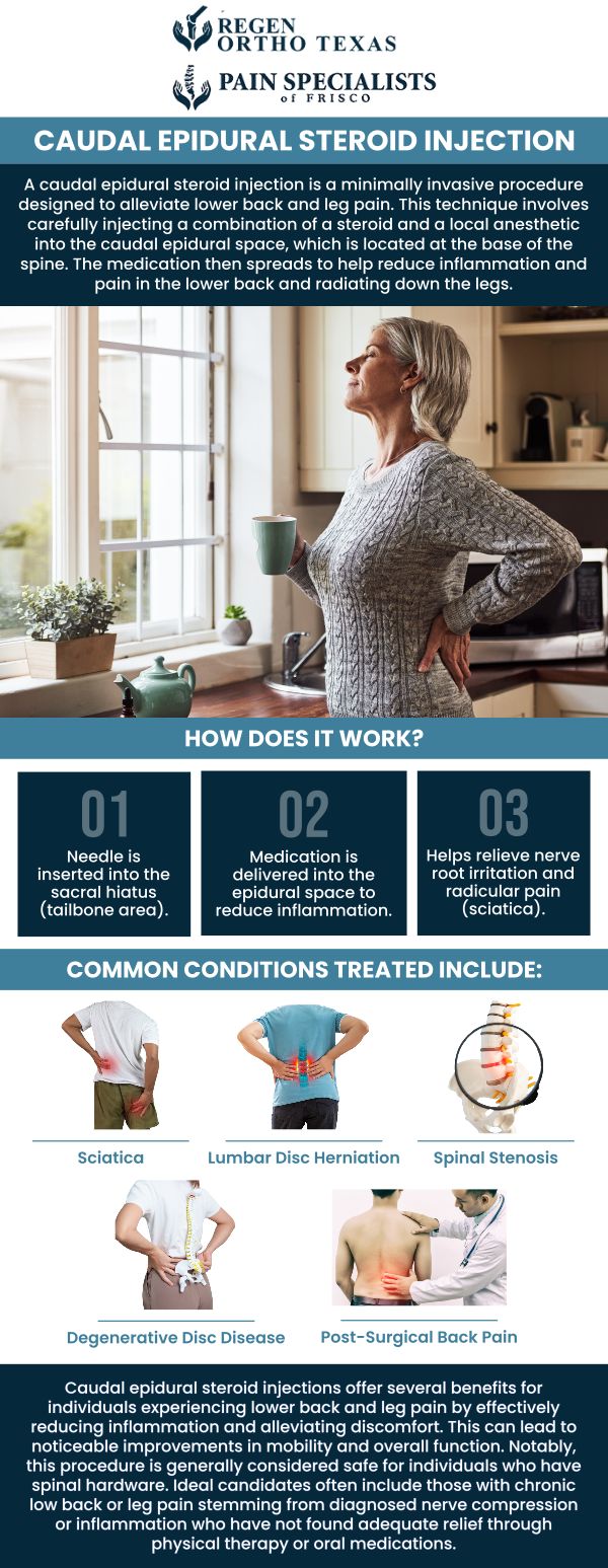 Caudal injections are safe, and quick steroid shots are injected into the lower back. Caudal epidural injections are helpful to reduce pain and inflammation in the lower back, often known as lumbar radiculopathy or sciatica pain. During the treatment, the needle is advanced through your epidural space. Our board-certified pain management specialist, Dr. Mahesh Mohan, MD, and his team at Pain Specialists of Frisco provide caudal epidural injections to relieve chronic lower back and leg pain. For more information, contact us or book an appointment online. We have convenient locations to serve you in Frisco, TX and Fort Worth, TX. Caudal injections are safe, and quick steroid shots are injected into the lower back. Caudal epidural injections are helpful to reduce pain and inflammation in the lower back, often known as lumbar radiculopathy or sciatica pain. During the treatment, the needle is advanced through your epidural space. Our board-certified pain management specialist, Dr. Mahesh Mohan, MD, and his team at Pain Specialists of Frisco provide caudal epidural injections to relieve chronic lower back and leg pain. For more information, contact us or book an appointment online. We have convenient locations to serve you in Frisco, TX and Fort Worth, TX.