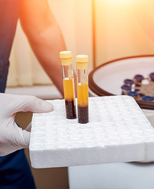 PRP Therapy at Pain Specialists of Frisco in Frisco, TX and Fort Worth, TX