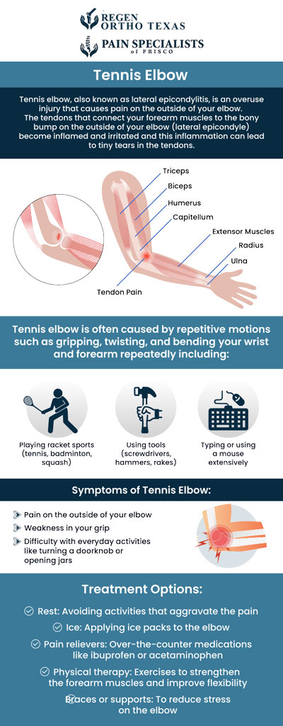 Common questions asked by patients: What is the best way to fix a tennis elbow? What is the reason for tennis elbows? How to check if you have a tennis elbow? What can be mistaken for tennis elbow? For more information, contact us or book an appointment online. We have convenient locations to serve you in Frisco, TX and Fort Worth, TX. We serve patients from Frisco TX, Fort Worth TX, Prosper TX, Little Elm TX, The Colony TX, Haltom City TX, Benbrook TX, North Richland Hills TX, and surrounding areas. Common questions asked by patients: What is the best way to fix a tennis elbow? What is the reason for tennis elbows? How to check if you have a tennis elbow? What can be mistaken for tennis elbow? For more information, contact us or book an appointment online. We have convenient locations to serve you in Frisco, TX and Fort Worth, TX. We serve patients from Frisco TX, Fort Worth TX, Prosper TX, Little Elm TX, The Colony TX, Haltom City TX, Benbrook TX, North Richland Hills TX, and surrounding areas.